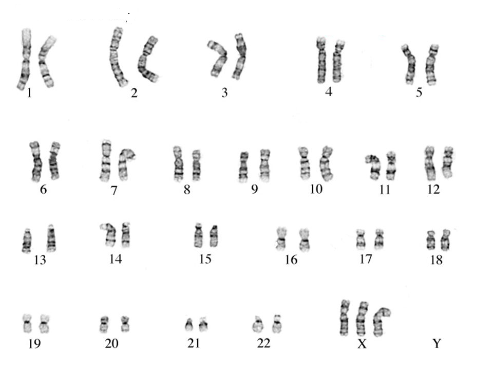 Index of /outreach-activities/paper-karyotypes/Karyotype worksheets/